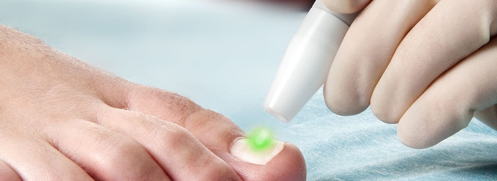 házi a kezelés gombák nail foot hogyan befolyásolja a lakk köröm gomba